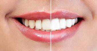 Restorative And Cosmetic Dentistry