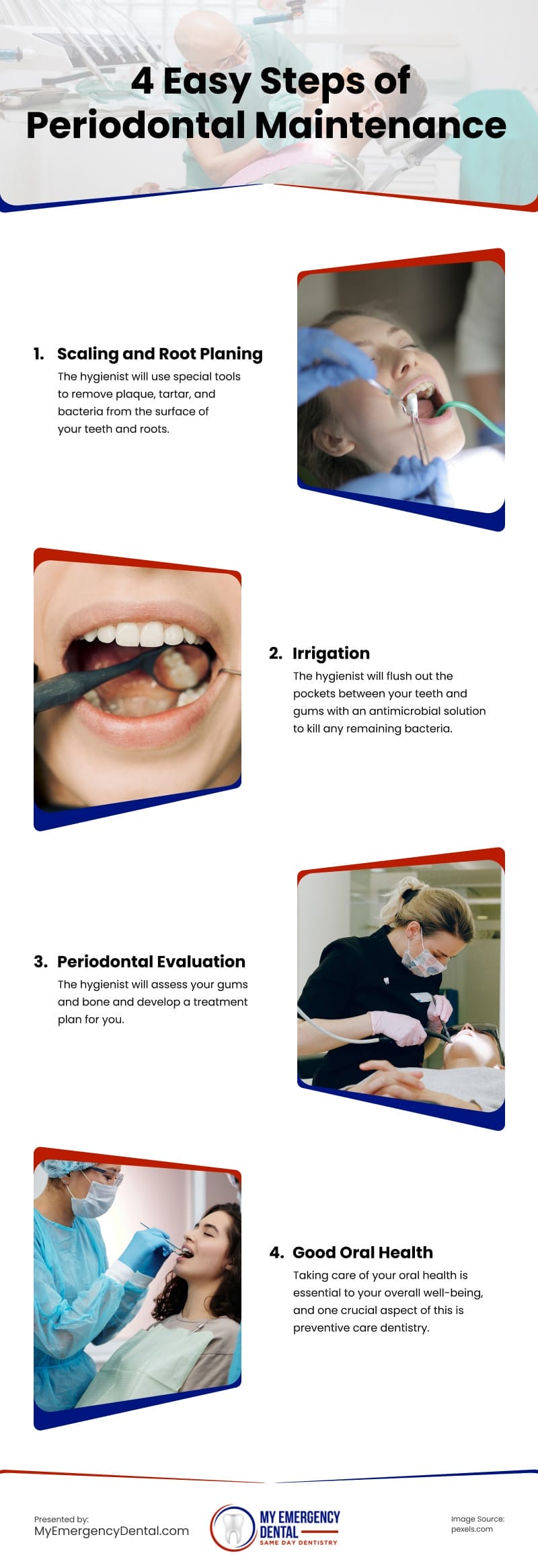 4 Easy Steps of Periodontal Maintenance Infographic