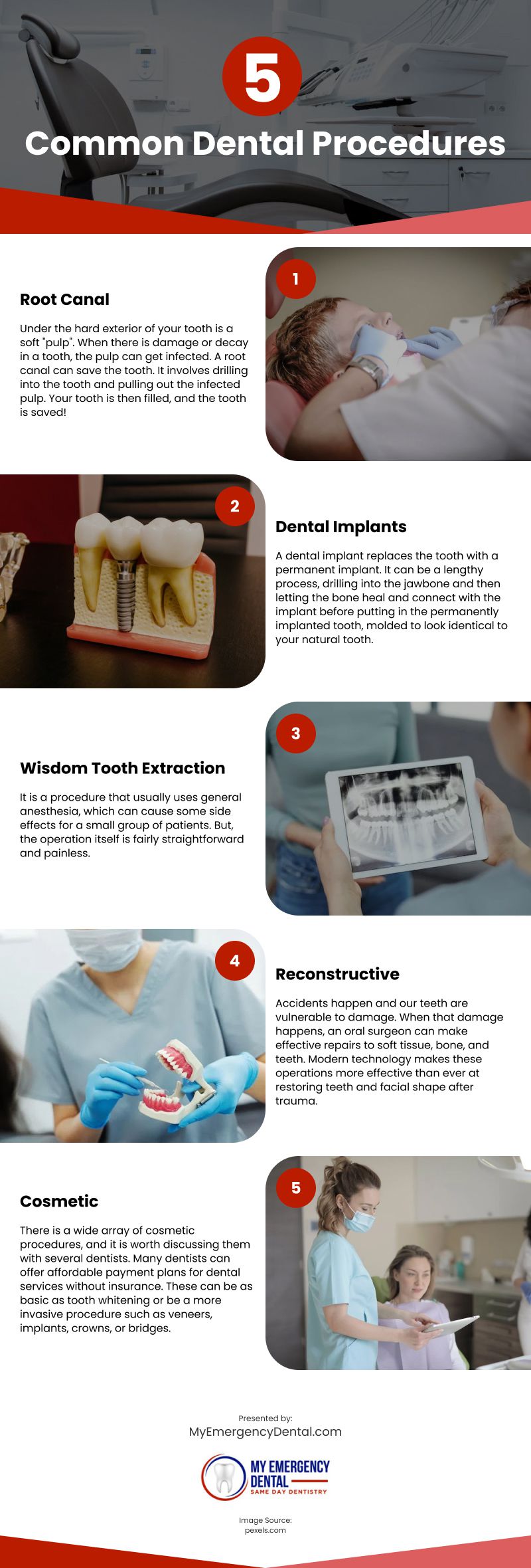5 Common Dental Procedures Infographic