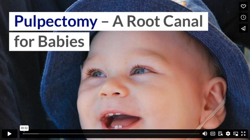 Pulpectomy–A Root Canal for Babies