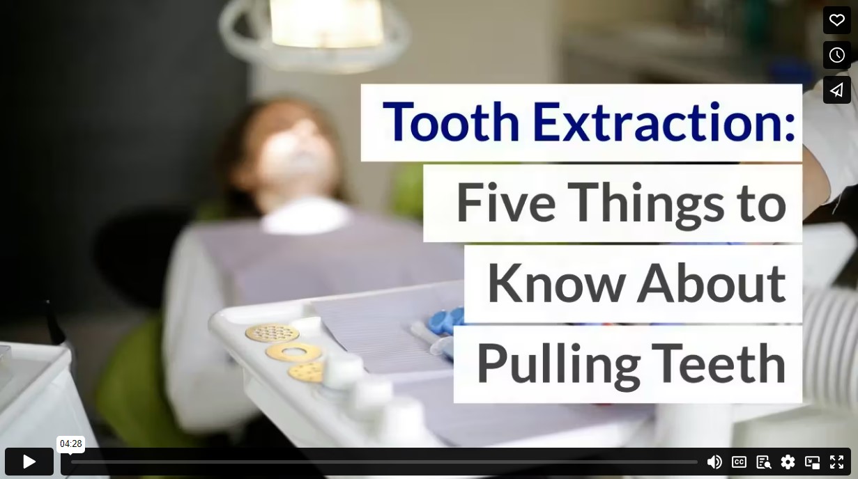 Tooth Extraction: Five Things to Know About Pulling Teeth