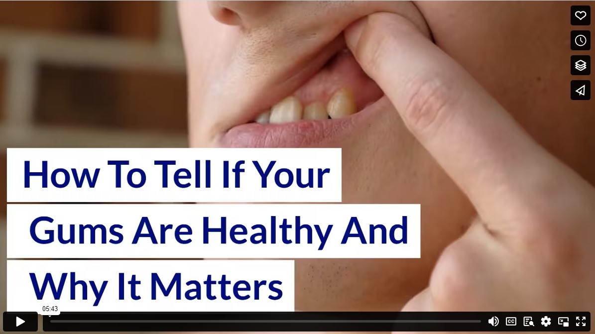 How To Tell If Your Gums Are Healthy And Why It Matters