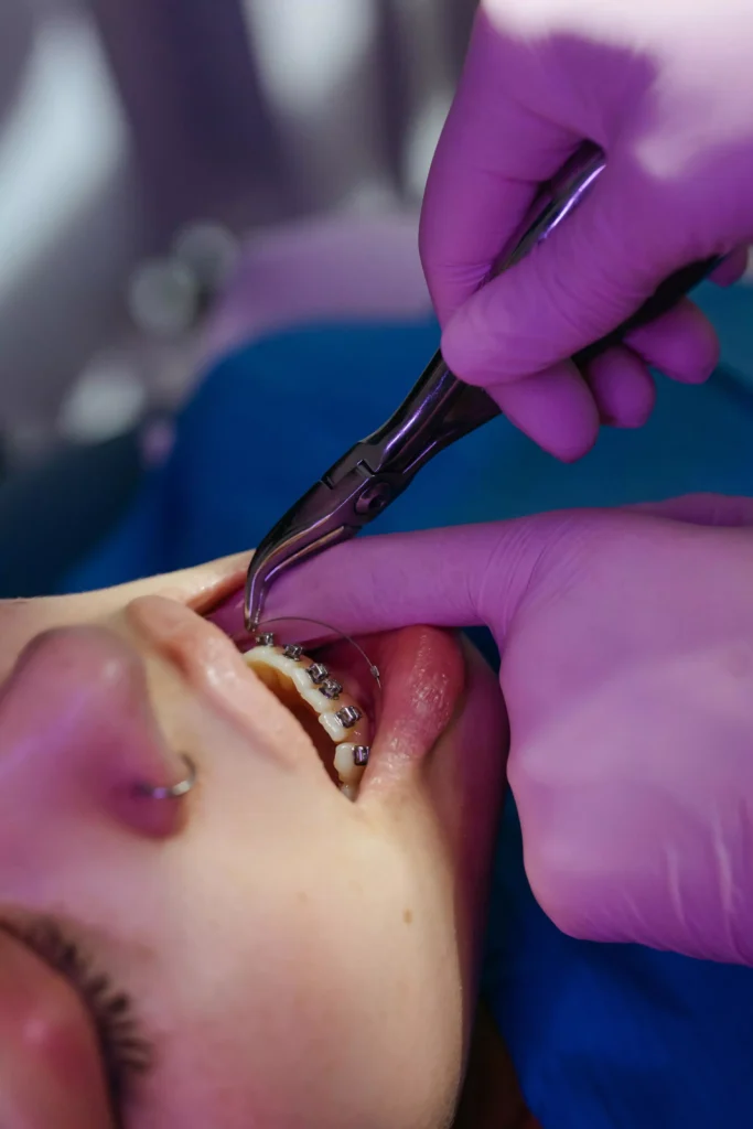 A girl receiving treatment from an orthodontist.