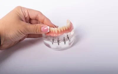 Get Your Smile Back with Dental Implants: A Comprehensive Guide
